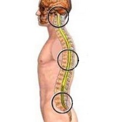 Hondroza kralježnice: simptomi, metode i režimi liječenja lumbalnog i sakralnog dijela leđa