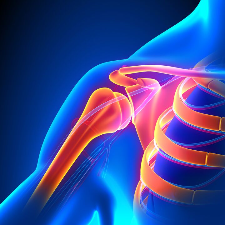 metode liječenja artroze ramenog zgloba