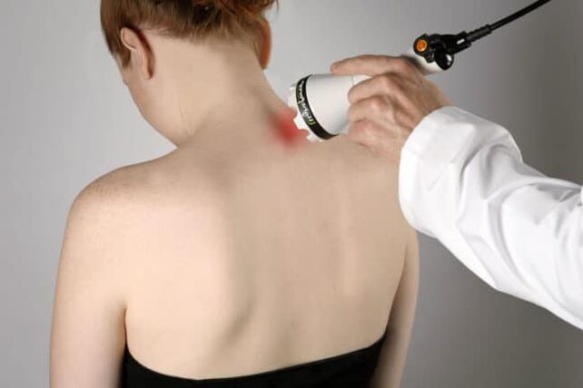 Laserska terapija se koristi za suzbijanje bolova u leđima u području lopatice. 