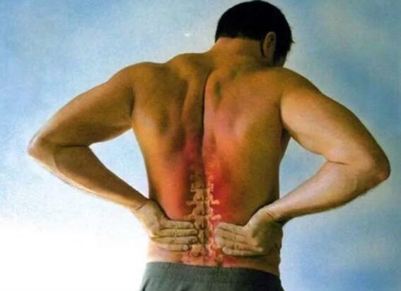 Bol za lumbalnu osteohondrozu